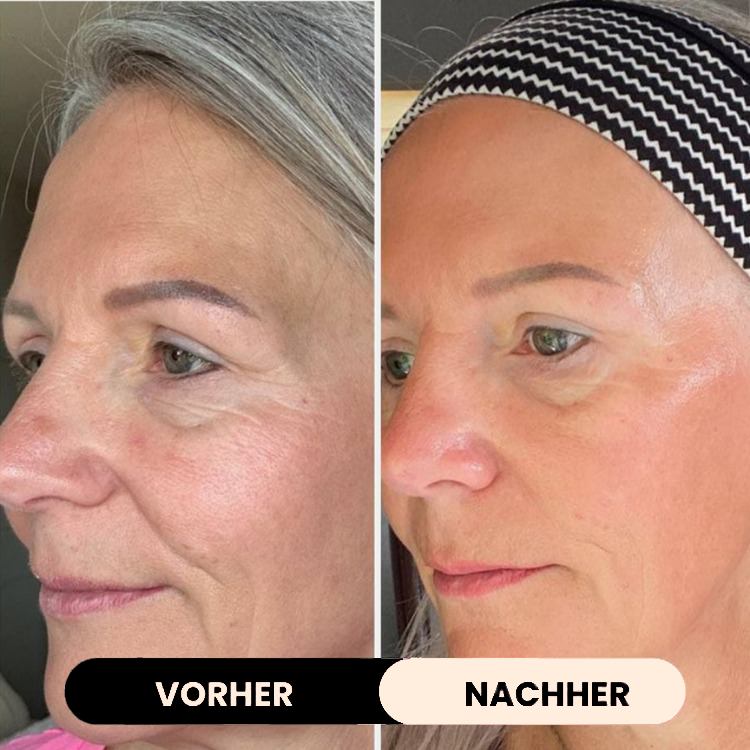 LUMORYA® – Bio-Kollagen Maske