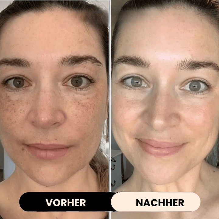 LUMORYA® – Bio-Kollagen Maske
